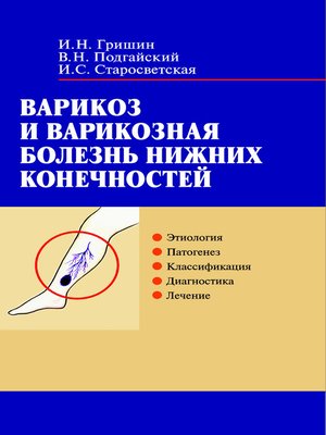cover image of Варикоз и варикозная болезнь нижних конечностей